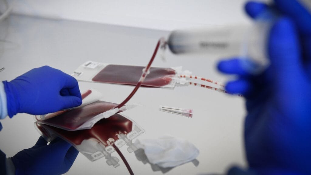 CAR T-Cell Therapy Market