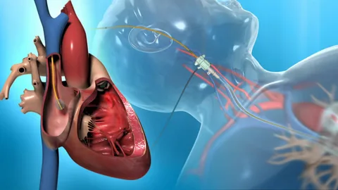 Cardiac Surgery and Heart Valve Devices Market