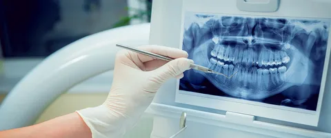 Dental Cameras Market
