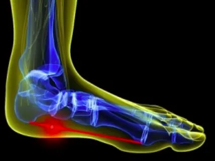 Dynamic Orthotics Market