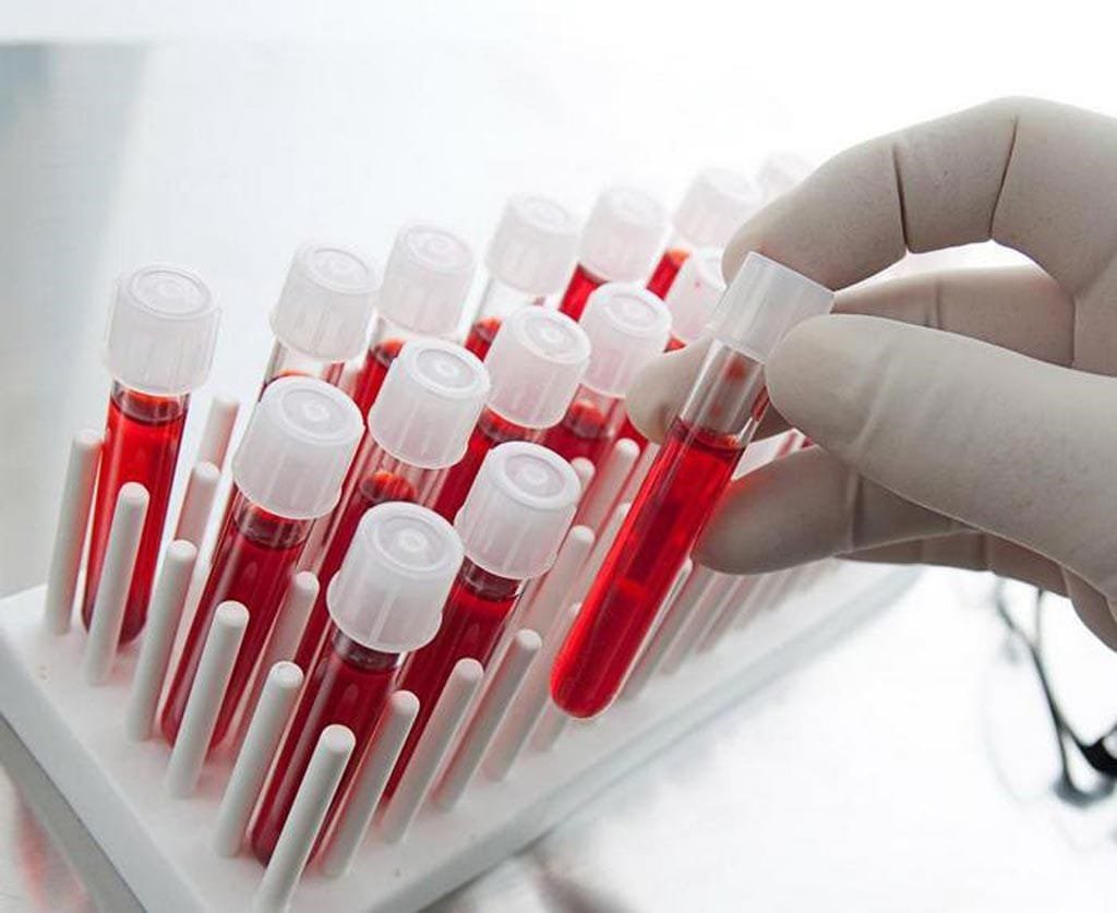 Blood Screening Market