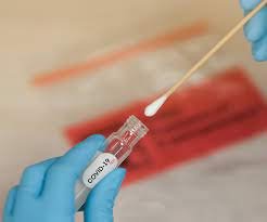 Nasopharyngeal Swabs market