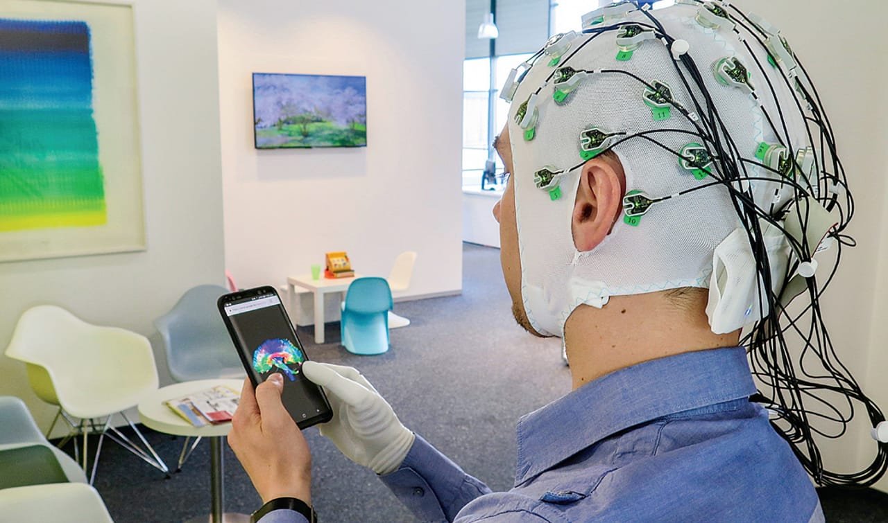 Neuroprosthetics Market