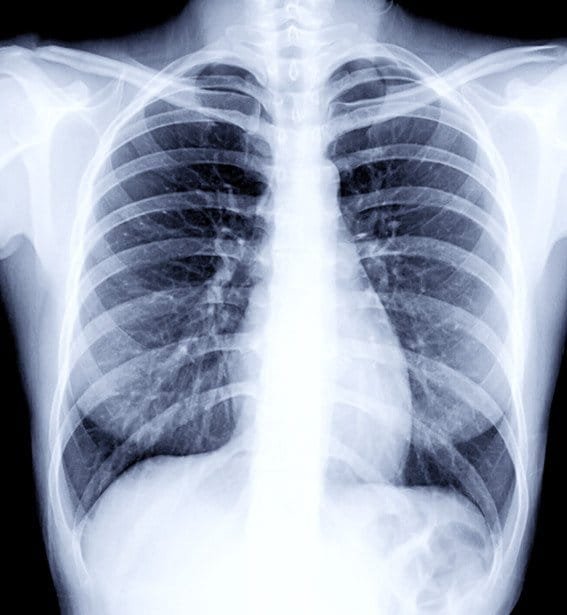 X-Ray Imaging Market