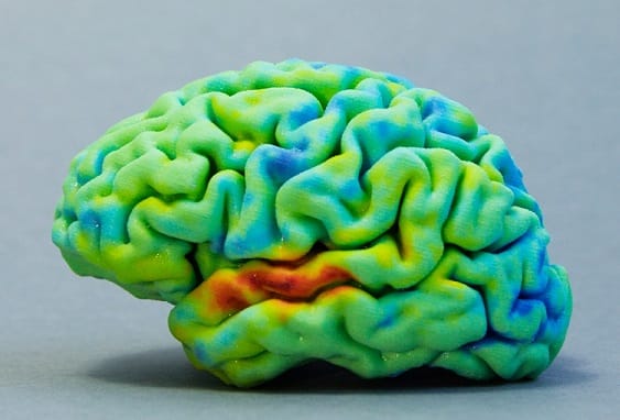 3D Printed Brain Model Market is projected to increase at a CAGR of ...