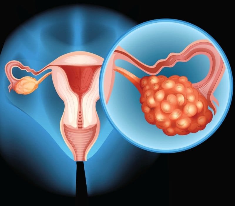Menstrual Cup Market