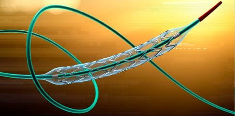 Neurovascular Devices/Interventional Neurology Market