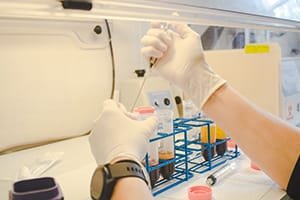 Amniotic Products Market