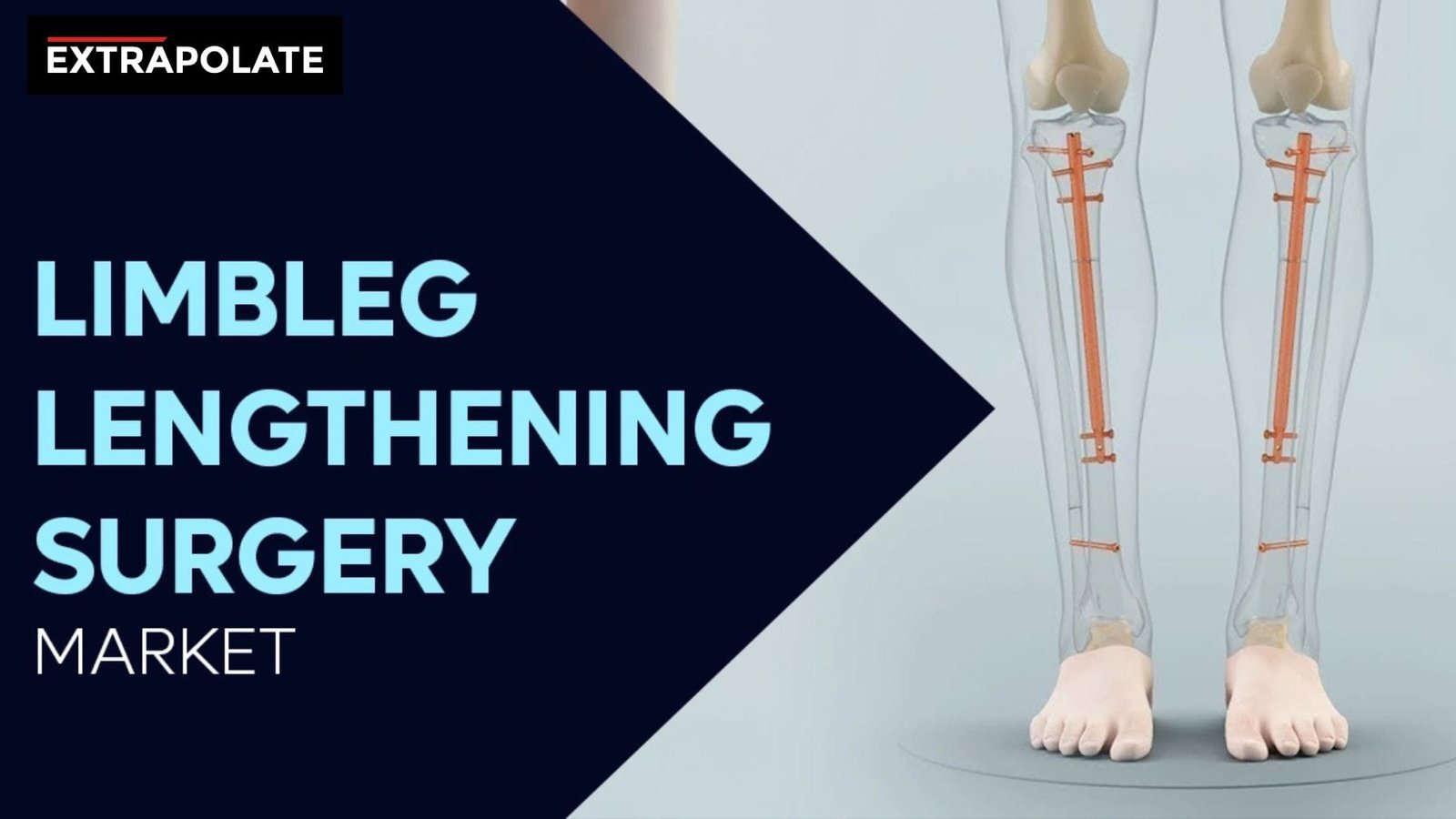 LimbLeg Lengthening Surgery Market