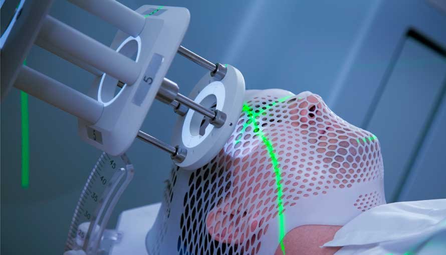 Radiotherapy Market