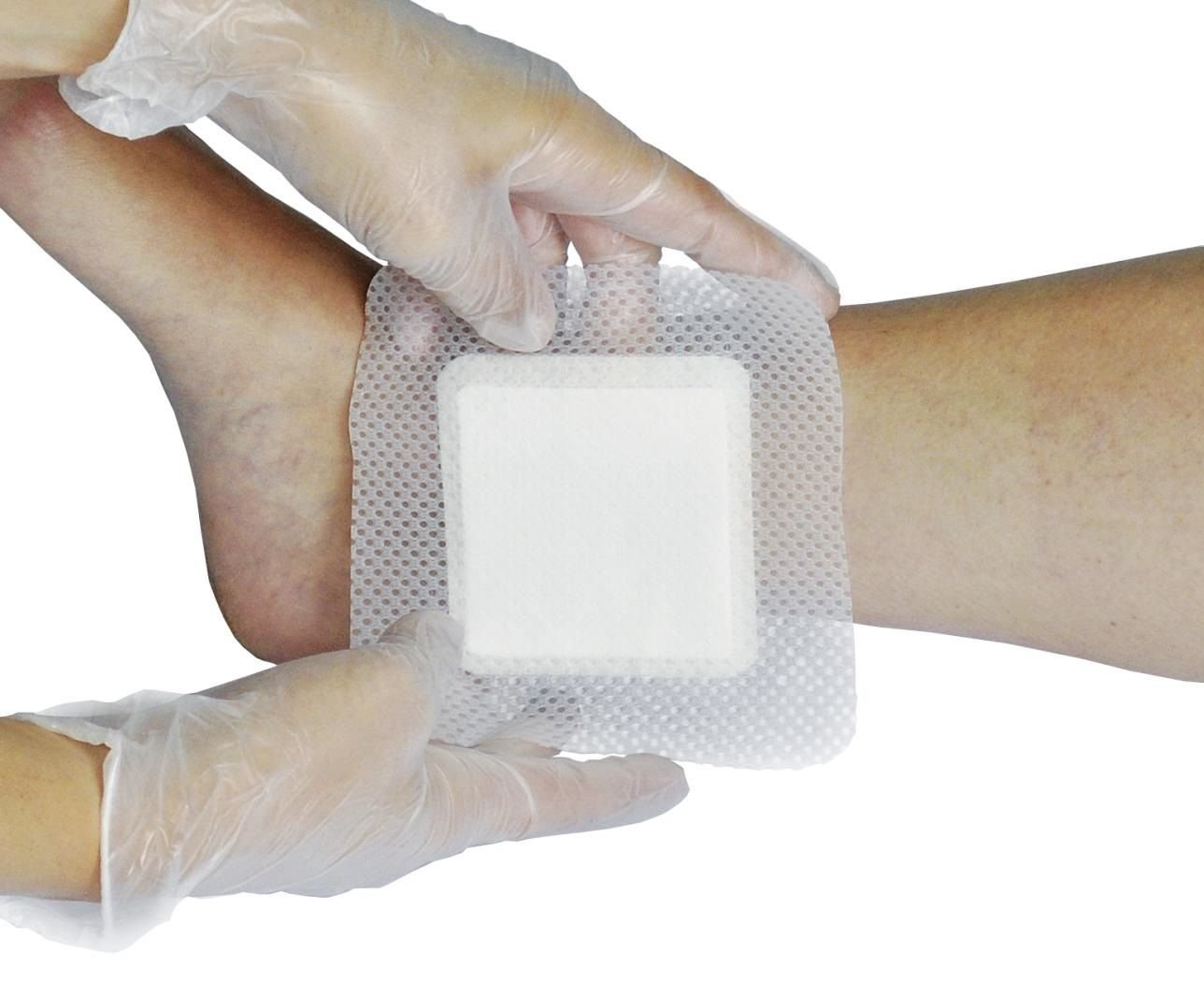 Wound Dressings Market