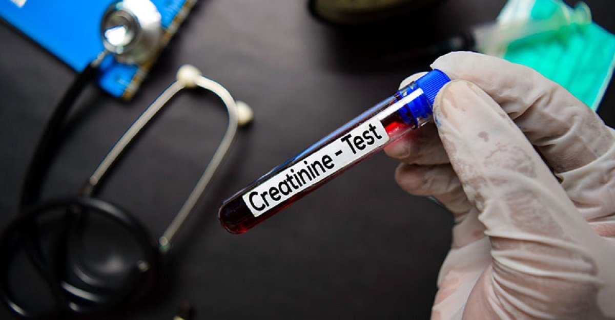 Creatinine Test Market