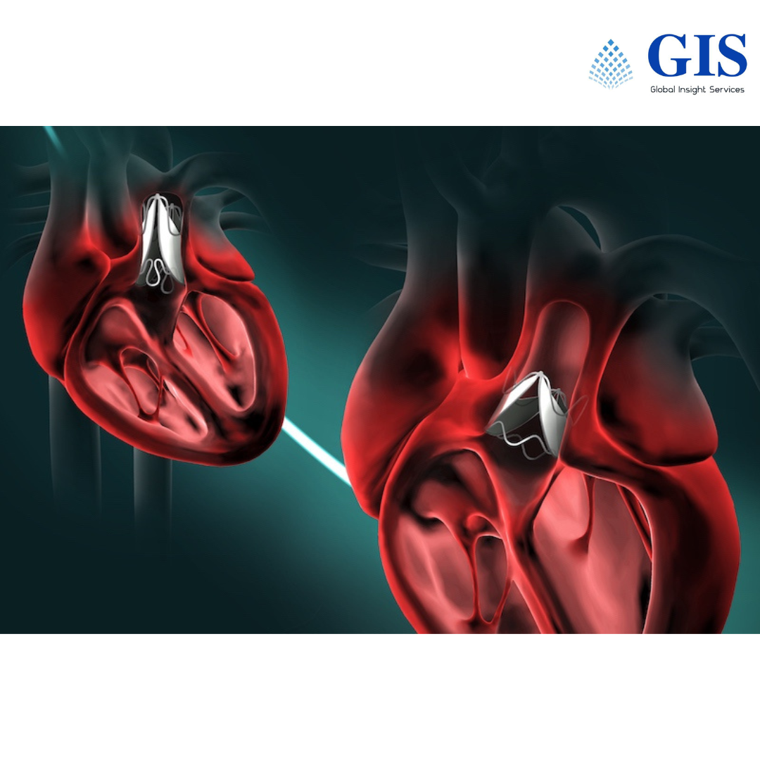 Prosthetic Heart Valve Market