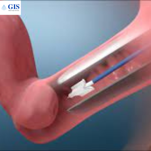 HPV Testing & Pap Test Market