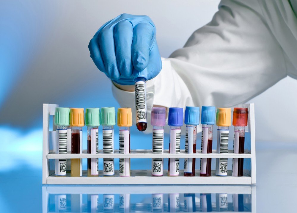 Serological Testing Market